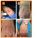 H3 Rapid Recovery Case Studies